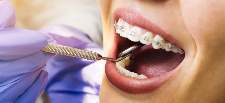 Why Choose Manchester for Your Dental Implants