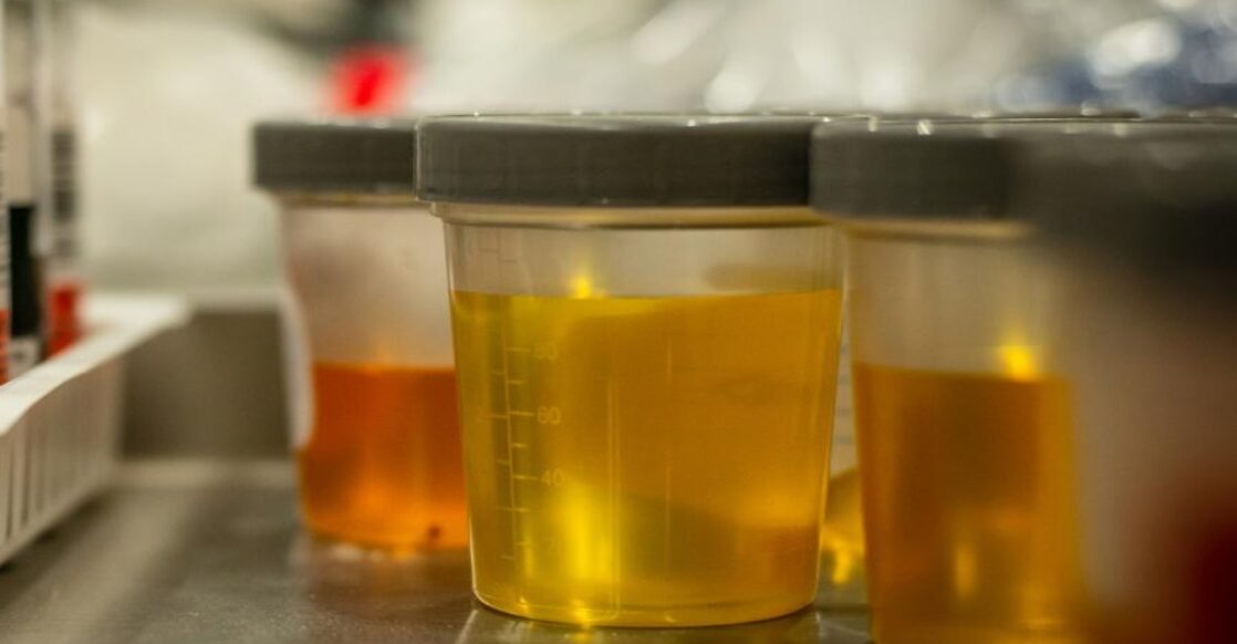 Synthetic Urine: Benefits for Individuals Facing Drug Screenings