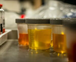 Synthetic Urine: Benefits for Individuals Facing Drug Screenings